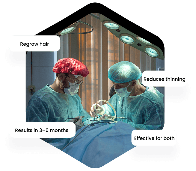 FUE hair transplant details