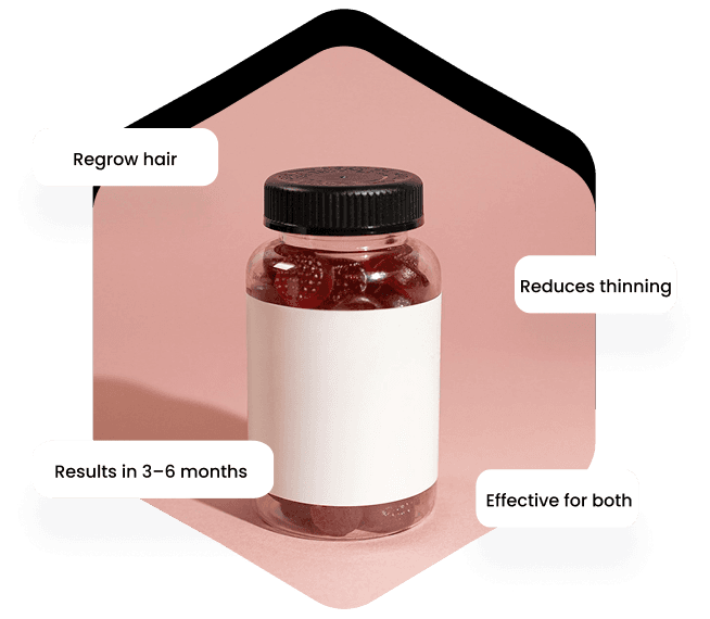 Minoxidil treatment details